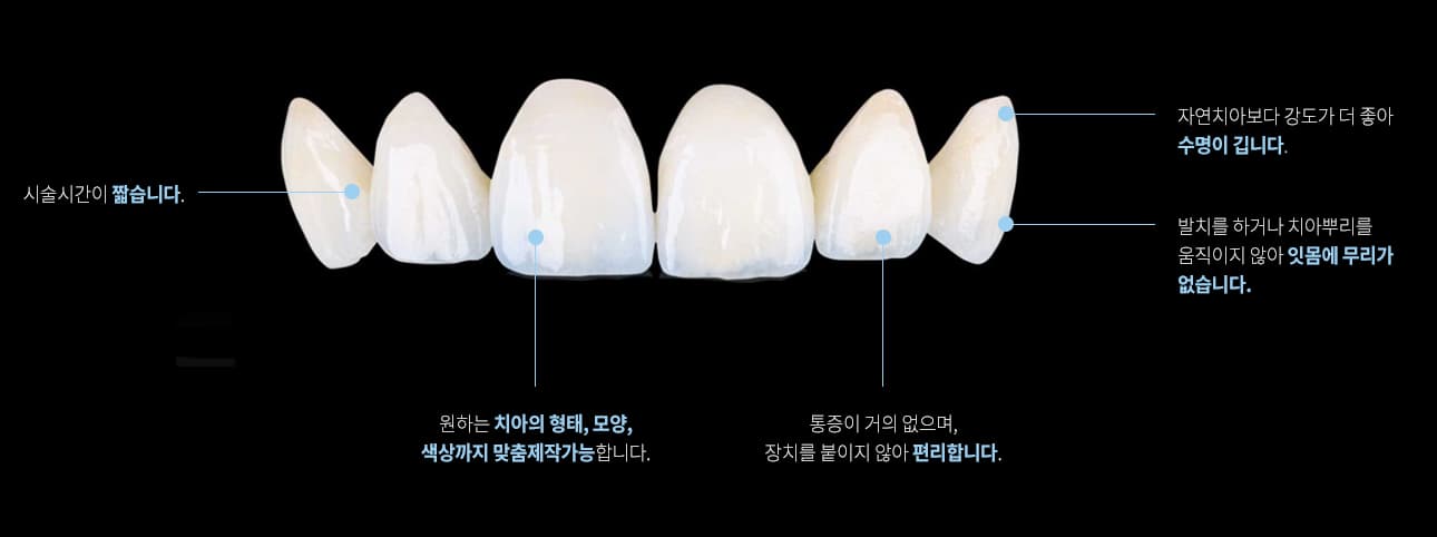 올세라믹 크라운 소재 설명
